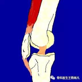 厉害了!人类膝关节使用说明书