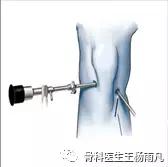 厉害了!人类膝关节使用说明书