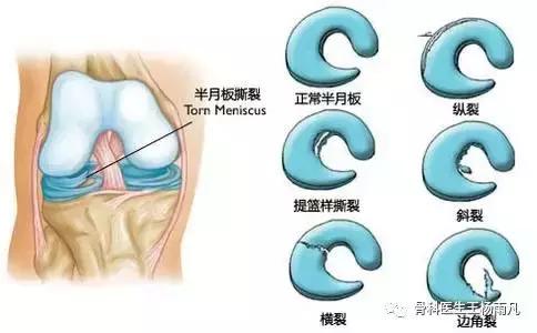 厉害了!人类膝关节使用说明书
