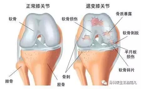 厉害了!人类膝关节使用说明书