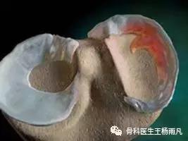 厉害了!人类膝关节使用说明书