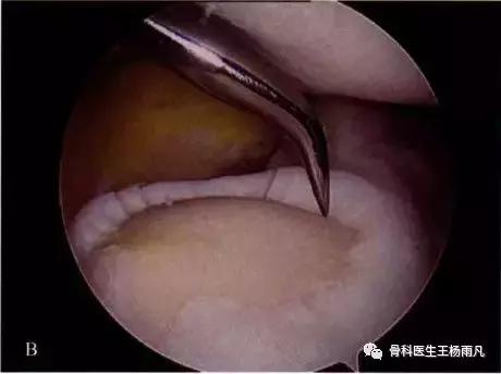 厉害了!人类膝关节使用说明书