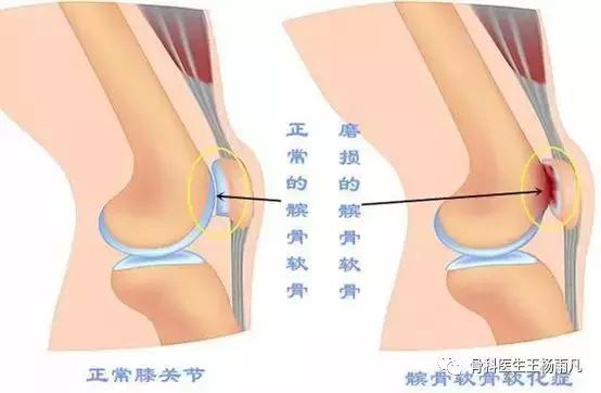 厉害了!人类膝关节使用说明书