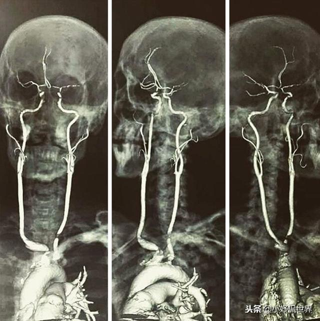 �̿����￴������23������ͼƬ Ҫ�ȿα��������Ȥ�ö�