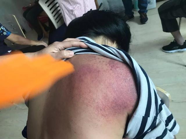 �˹��������Ÿ���������������ʮ�㣬Զ�뺮ʪ