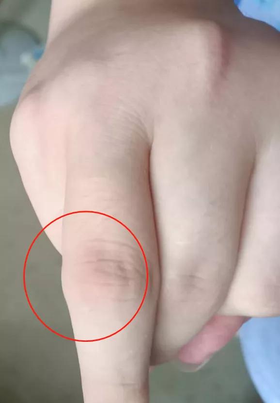 ��ʹ������ѽſ��ˣ���18��ѧ����ʹ����ĥ4�꣡�ؽڳ�����ʯͷ��