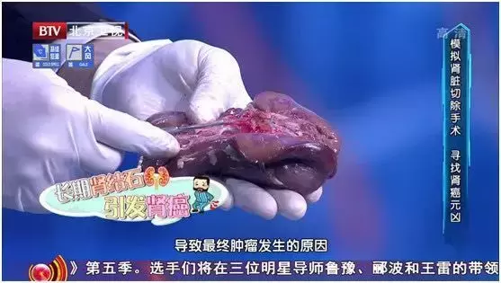 �ܶ��ʯ���ǡ��ԡ������ģ���Щ������ʳϰ������������