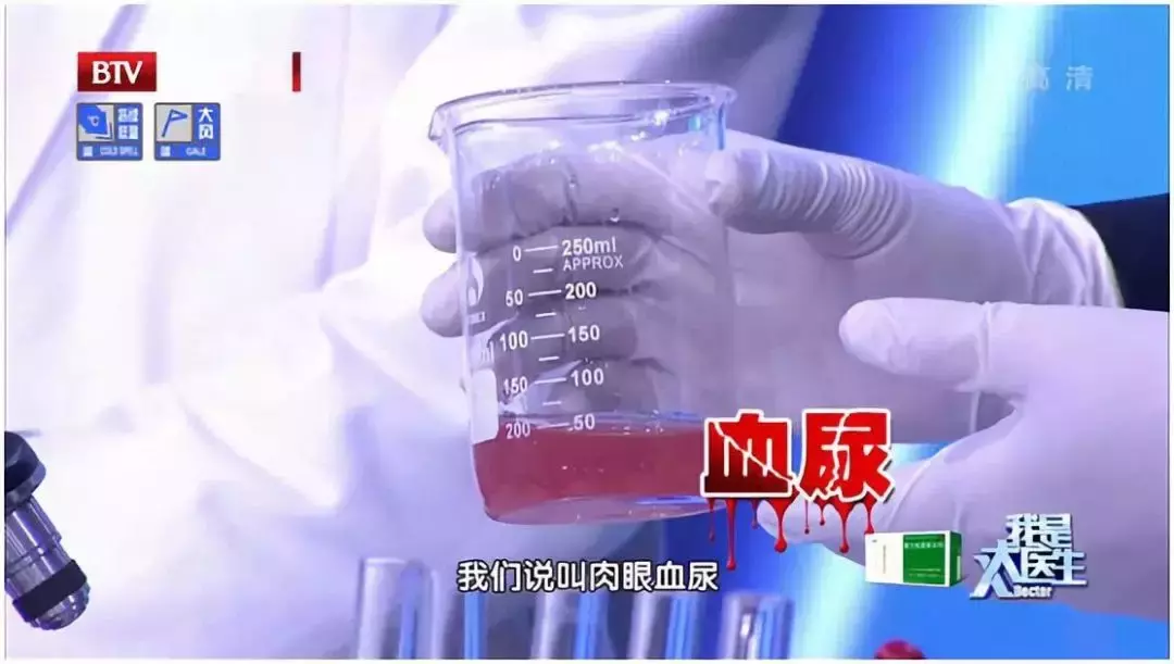 �ܶ��ʯ���ǡ��ԡ������ģ���Щ������ʳϰ������������