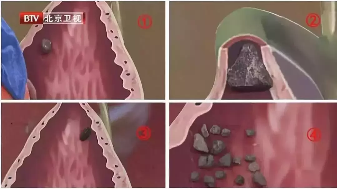 �ܶ��ʯ���ǡ��ԡ������ģ���Щ������ʳϰ������������