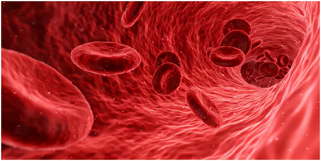 警惕!天天都在吃的家常菜,竟可能是“血管杀手”