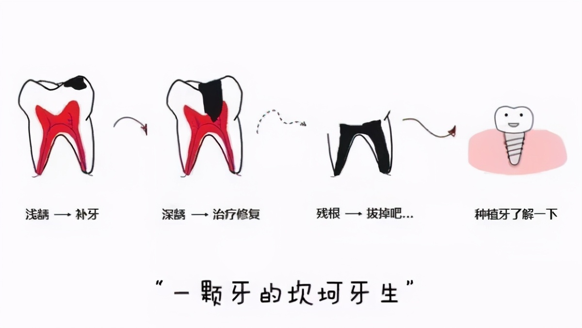 最全儿童换牙时间表!特别是「六龄齿」,一坏就是一辈子